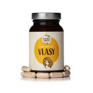 Krásné Vlasy